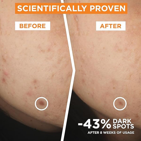 Garnier Skin Active, Face Serum, Brightening & Anti-Dark Spots, 3.5% Vitamin C, 30 ml